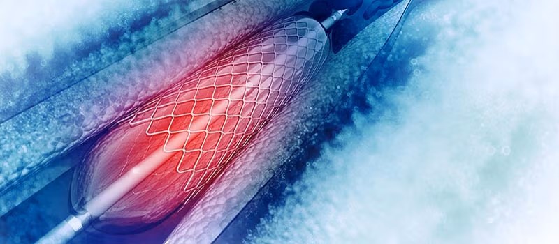 Cardiac Catheterization